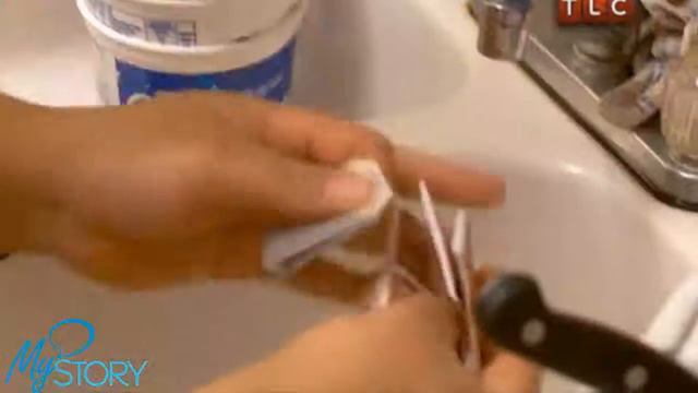 Гигантская мошонка - Моя Ужасная История смотреть онлайн