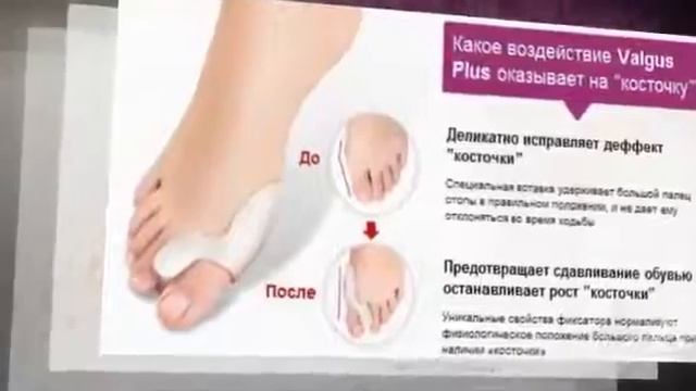 ValguPro Medicus - двойной корректор большого пальца смотреть онлайн