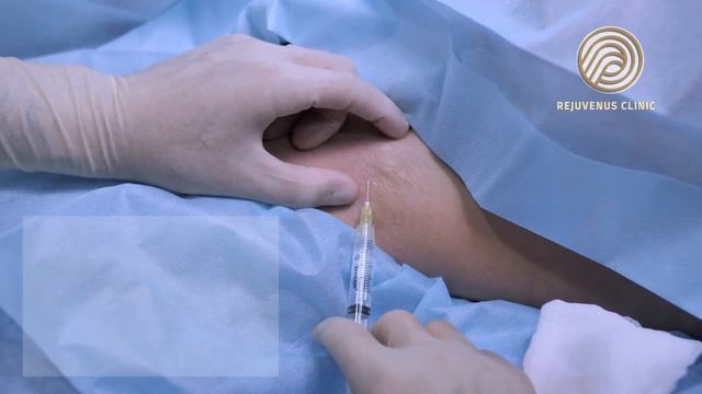 Botox vs Fillers: What's the Difference? | Rejuvenus Clinic смотреть онлайн