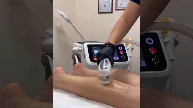 Asclepion Mediostar в Мир эпиляции смотреть онлайн