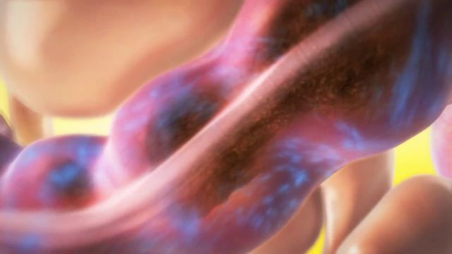 Bowel Cleansing смотреть онлайн