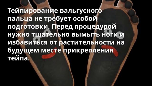 Кинезиотейпирование косточки на ноге смотреть онлайн