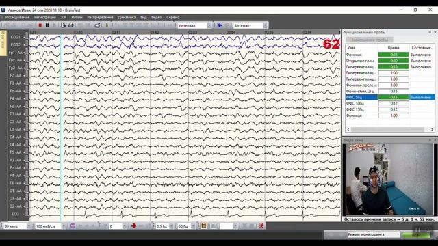 Регистрация энцефалограммы смотреть онлайн