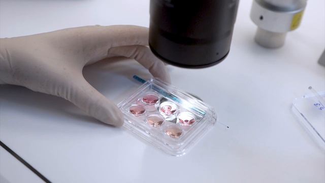 Криоконсервация эмбрионов, все о заморозке и разморозке эмбрионов смотреть онлайн