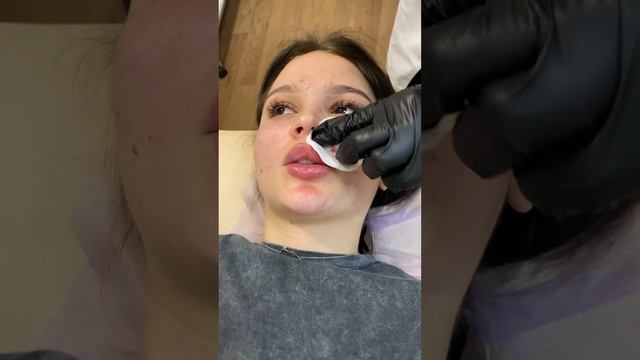Обязательно разминайте губы 10 дней после увеличения, это делается для красоты формы. смотреть онлайн