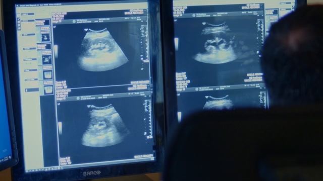 King Hamad University Hospital modernizes healthcare with Oracle APEX смотреть онлайн