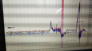диагностика двигателя renault clio осциллографом.