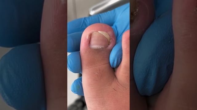 #pedicure #toenails Daily pedicure! смотреть онлайн