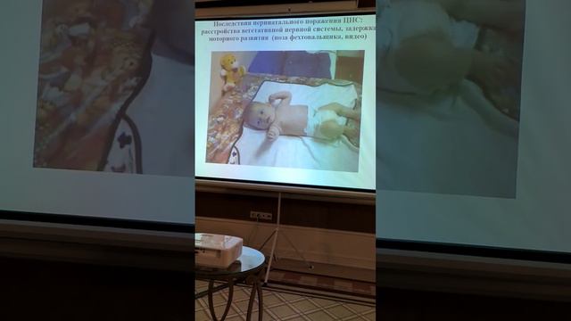 Перинатальное поражение ЦНС смотреть онлайн