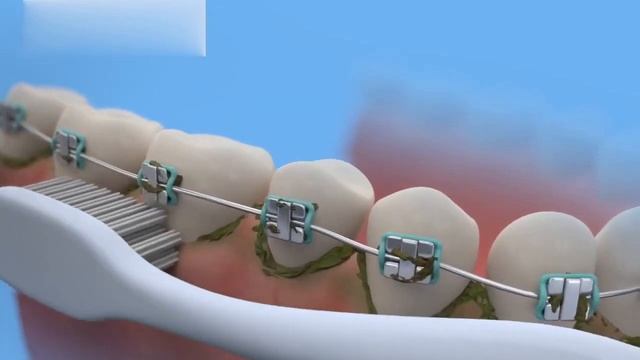 Water Flosser смотреть онлайн