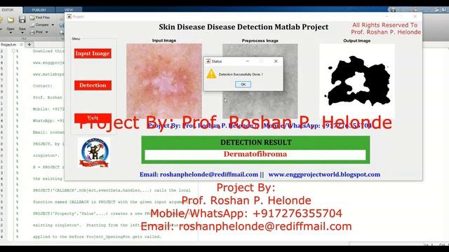 Skin Disease Detection Using Image Processing | With Source Code Matlab Project Skin Disease Detect смотреть онлайн