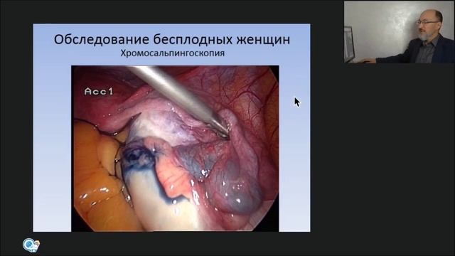 Лекция Бесплодие смотреть онлайн