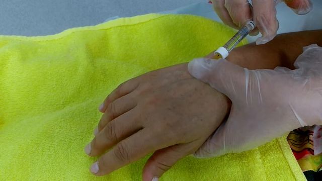 Биоармирование рук смотреть онлайн