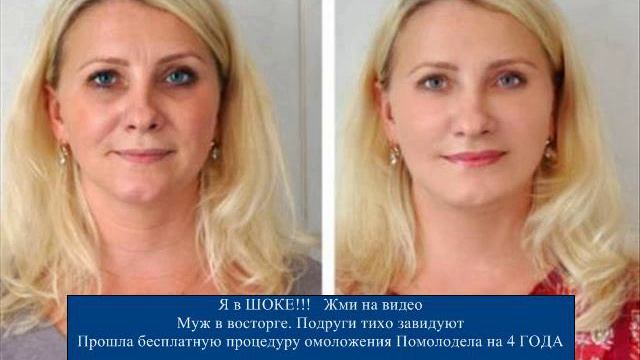 Виктория Боня Про Пилинг Хлористым Кальцием [Домашние Пилинги Для Лица] смотреть онлайн