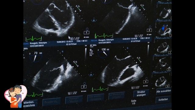 Bebi im - 9 jave shtatzene (shtatzania jave pas jave) смотреть онлайн