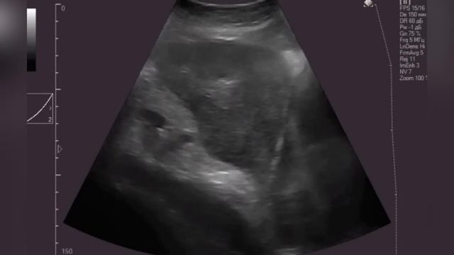 Carpe diem, memento mori! Памяти Милы Тумановой. Рак молочной железы 4 стадии смотреть онлайн