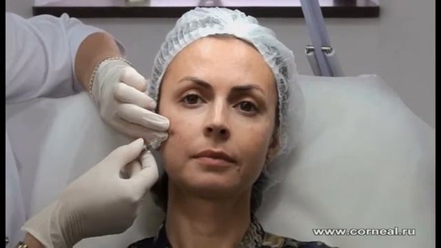 Разметка может мешать смотреть онлайн