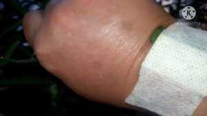 Алоэ для раны#рецепт  заживления