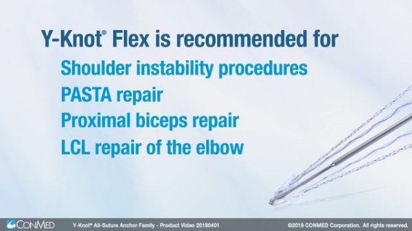 Y-Knot® All-Suture Anchor Family - CONMED Product Video