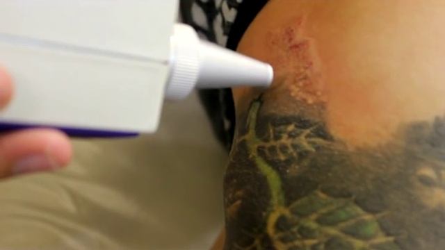 удаление татуировки лазером.avi смотреть онлайн
