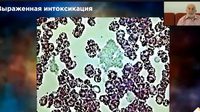 Так выглядит кровь здорового человека смотреть онлайн