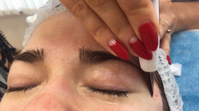 Комбинированная ультразвуковая чистка "Т зоны" лица смотреть онлайн