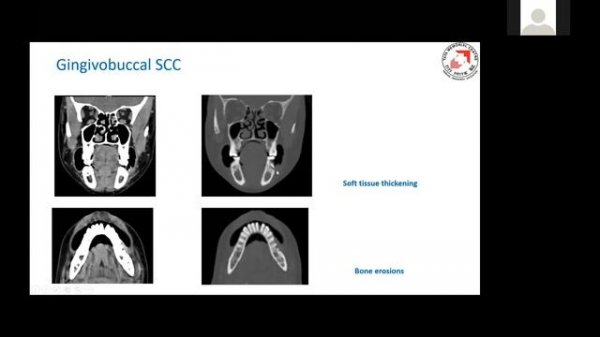 Imaging oral cavity case based approach