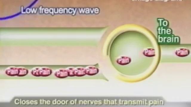 М3-кубическая волна (m-cube wave) для омоложения лица и тела смотреть онлайн