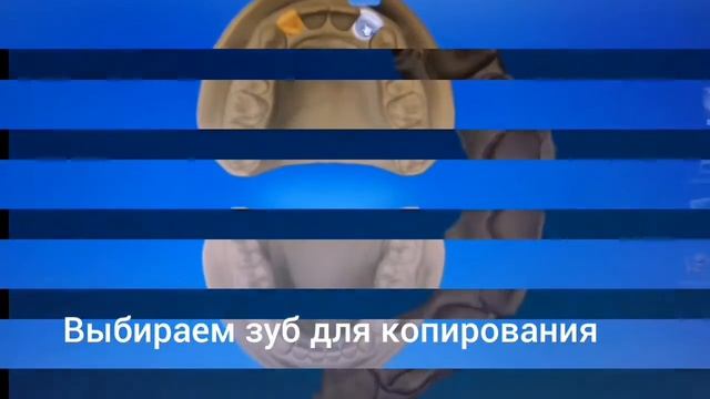 Cerec, моделирование реставрации (репликация) смотреть онлайн