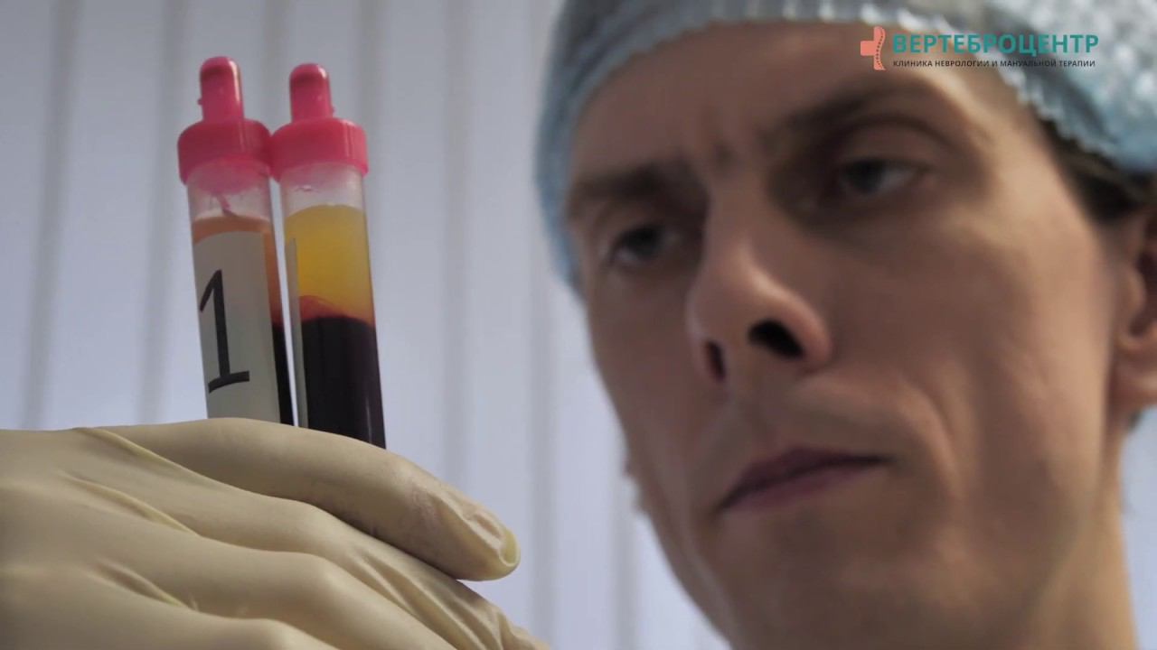 Плазма обогащённая тромбоцитами. PRP