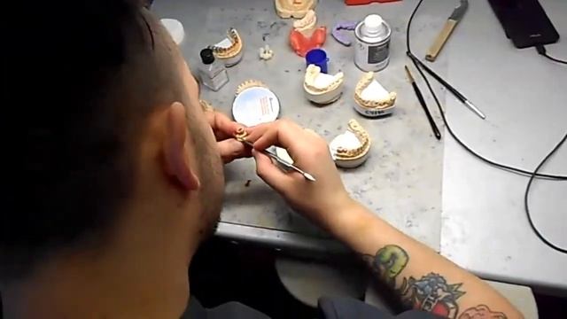 Наши зубные техники смотреть онлайн