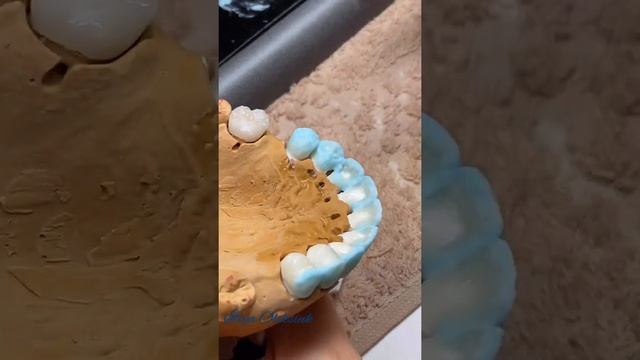 Crowns On Refractory керамика зубной техник Техника нанесения Dental Technician Technik Dentystyczn