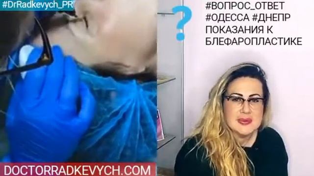Dr.Radkevych_PR: ВОПРОС-ОТВЕТ "ПОКАЗАНИЯ К БЛЕФАРОПЛАСТИКЕ", отвечает ВРАЧ-ХИРУРГ ВИКТОРИЯ РАДКЕВИЧ смотреть онлайн