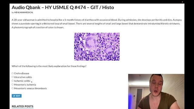 HY USMLE Q #474 – GIT / Histo смотреть онлайн