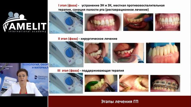 Профилактика в комплексном лечении заболеваний пародонта – Оксана Копчак смотреть онлайн