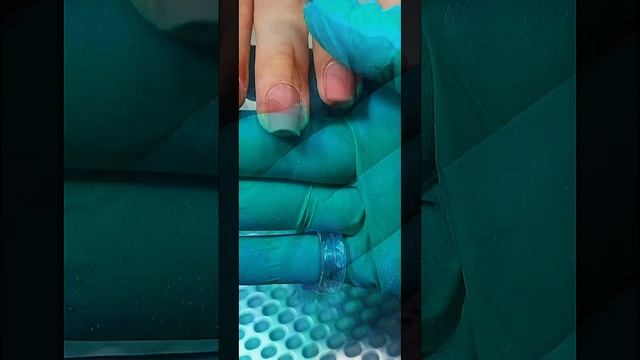 коррекция клюющих ногтей смотреть онлайн