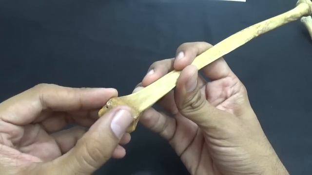 radius- attachments смотреть онлайн