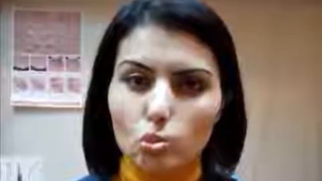 Лала рабочая сессия 1 Неврит лицевого нерва на фоне шванномы Восстановление смотреть онлайн