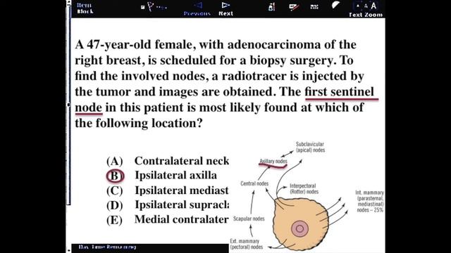 USMLE Practice Questions and Answers #47 | Sentinel lymph node & Anatomy смотреть онлайн