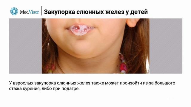 Закупорка слюнных желез у детей: что её вызывает? смотреть онлайн