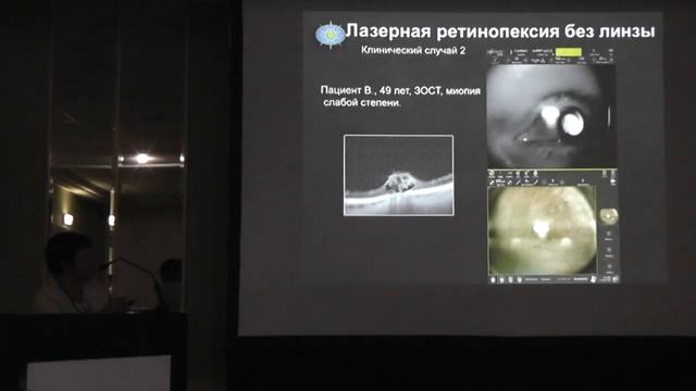 Особенности лазерной ретинопексии. Шаимова В.А. («Центр Зрения», г.Челябинск) смотреть онлайн