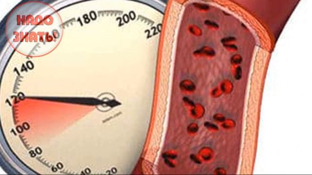 Почему понижается (падает) давление? 7 главных причин!