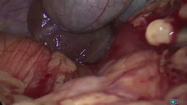 Региональный мастер-класс "Малоинвазивные технологии в онкохирургии в вопросы лекарственной терапии смотреть онлайн