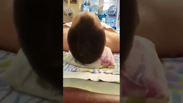 Почему не надо оперировать краниостеноз