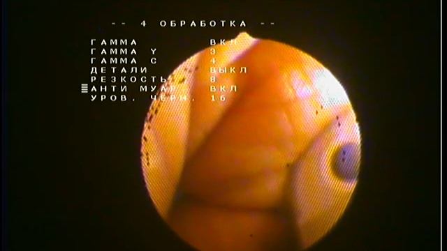 Эндовидеокамера EVK-001 (63) с гибким эндоскопом Pentax (универсальный адаптер) смотреть онлайн