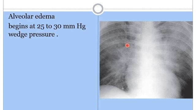 week 22 cardiac anatomy, physiology and imaging смотреть онлайн