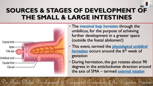 DEVELOPMENT OF THE HOLLOW GIT SECTION II - ESOPHAGUS, STOMACH, INTESTINES & ANTERIOR ABDOMINAL WALL смотреть онлайн