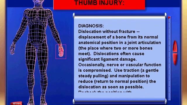 Emergency Room: Disaster Strikes - Case 244 - Jammed thumb (Edwin Martinez, MCP dislocation) смотреть онлайн
