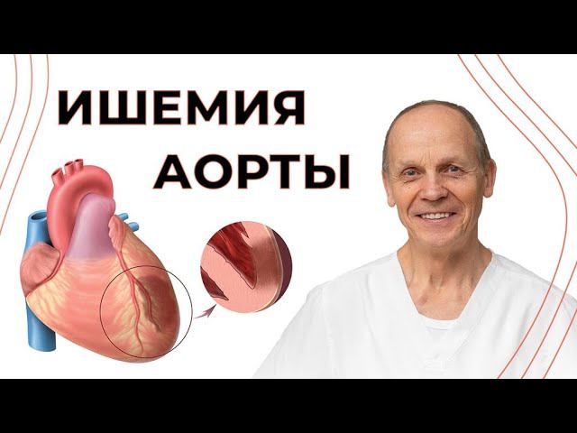 Ишемия АОРТЫ | Огулов А.Т. смотреть онлайн