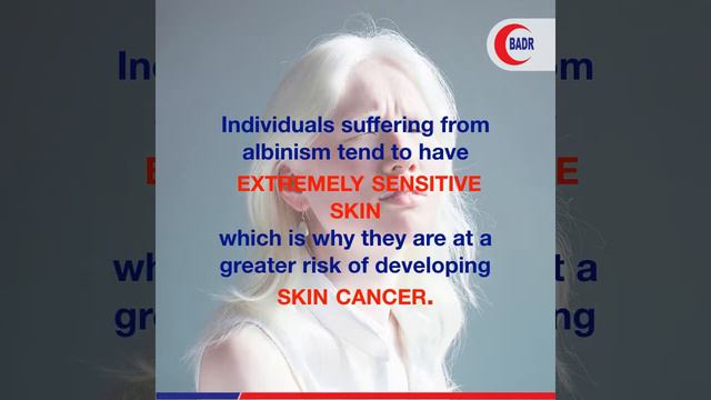 Albinism Awareness Day смотреть онлайн